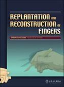 Replantation and Reconstruction of Fingers