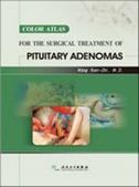 Color Atlas for Surgical Treatment of Pituitary Adenomas